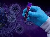  Na wykonanie testów czeka jeszcze około 130 mieszkańców powiatu kłodzkiego 