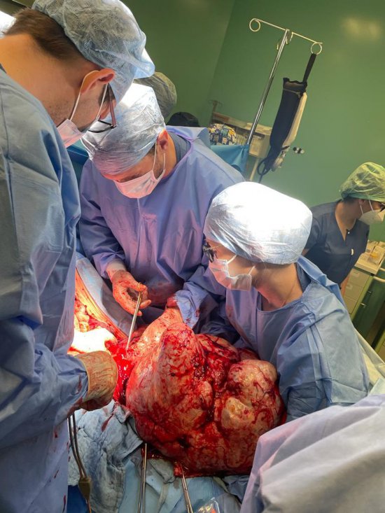 [FOTO] Usunęli pacjentce guza, który ważył 20 kg! Uwaga! Drastyczne zdjęcia 